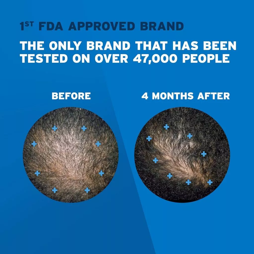 Rogaine Foam Minoxidil 5% For Men - Image 4